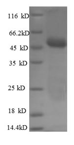 Human CA12 protein