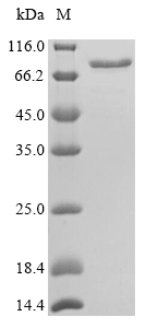 Mouse Calr protein