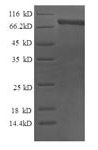 Human CAPN2 protein
