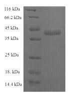 Human CCL25 protein