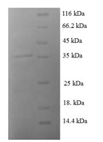 Human CCL8 protein