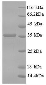Human CD59 protein