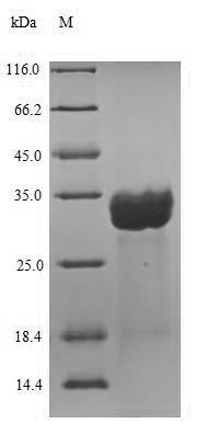 Human CETN2 protein