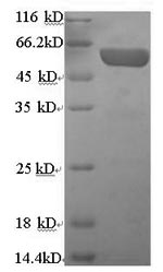 Human CHGA protein