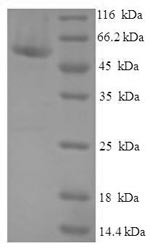 Human CIAO1 protein