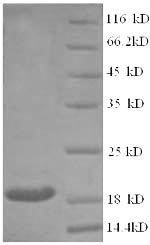 Human CLTCL1 protein