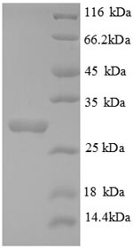 Human Collagen IV protein