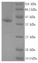 Human CRADD protein