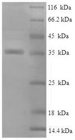 Human CRYAB protein