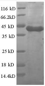 Human CSNK1A1 protein
