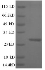 Mouse Ctsk protein