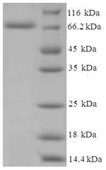 Human CYP11A1 protein