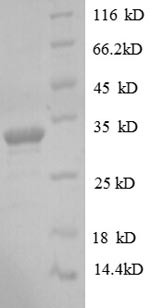 Human DLK1 protein