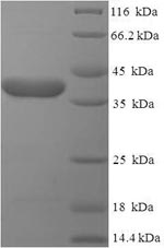 Human EBAG9 protein