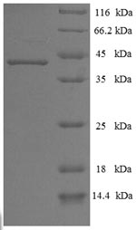 Human CELA3A protein