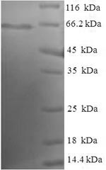 Human EML2 protein