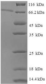 Human EPHX1 protein