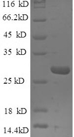 Human EPPK1 protein