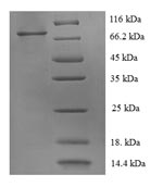 Human ERBB2 protein