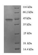 Human FAM110B protein
