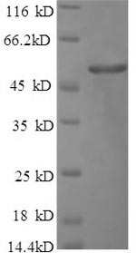 Human Fibrinogen alpha protein