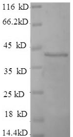 Human FGFR3 protein