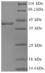 Human FKBP3 protein