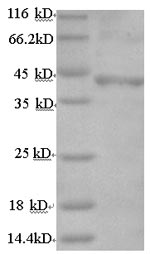 Human FSHR protein