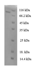 Human GALNS protein