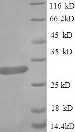 Rat Gamt protein