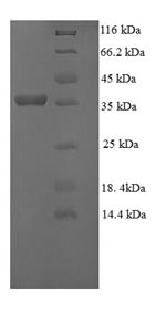 Human GGCT protein