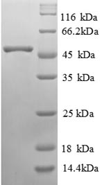 Human GLA protein