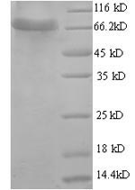 Human GLCE protein