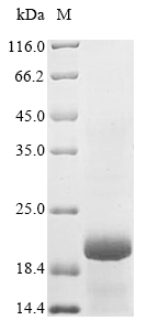 Human GLP1R protein