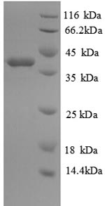 Human GLRX protein