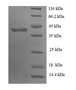 Human GLT8D2 protein