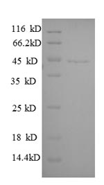 Human GNAI3 protein