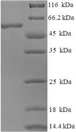 Human GNB5 protein