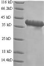Human GNRH2 protein