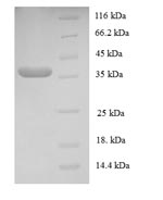 Human GTF2E2 protein