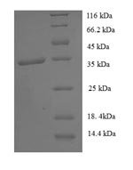 Human GTF2H5 protein