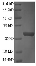 Human GZMB protein