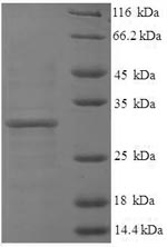 Human H3F3A protein