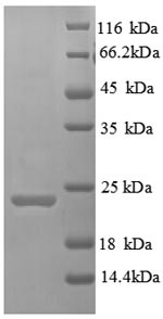 Human HAVCR2 protein