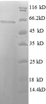 Human HDAC3 protein