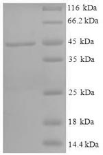 Human HSD11B1 protein