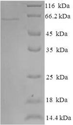 Human IDO2 protein