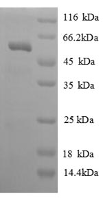 Human KLK7 protein