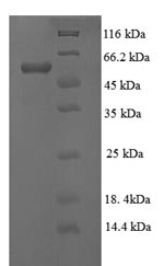Human LOXL1 protein