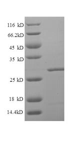 Human LRBA protein
